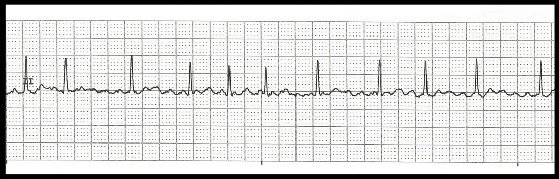 Cardiac Case Study Assignment Help